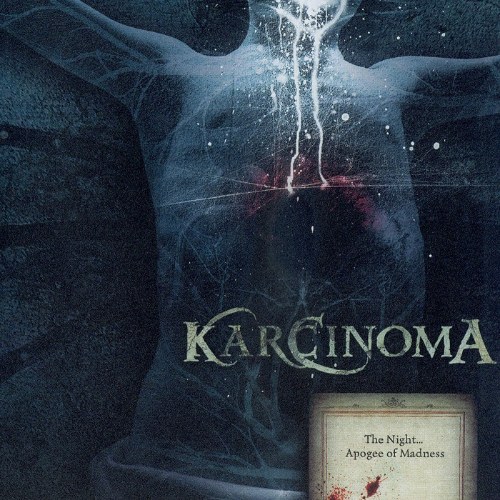 Karcinoma